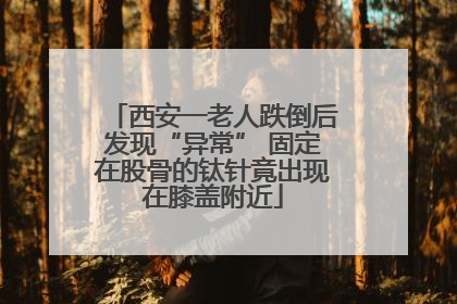 西安一老人跌倒后发现“异常” 固定在股骨的钛针竟出现在膝盖附近